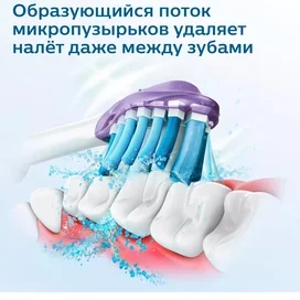 Набор электрических звуковых зубных щеток Philips HX9914/57 фото #2